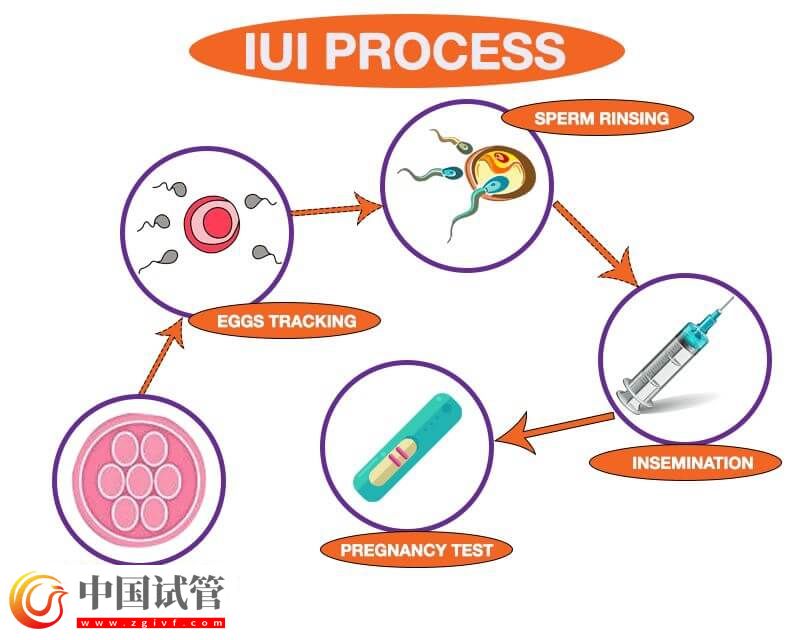 吉安市婦幼保健院人工授精的治療流程是怎么樣的？(圖1)