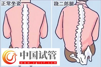 不良體態(tài)正悄悄損害你的健康(圖2)