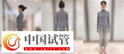 不良體態(tài)正悄悄損害你的健康(圖4) 不良體態(tài)正悄悄損害你的健康(圖4)