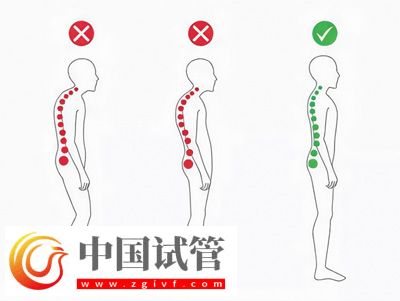 不良體態(tài)正悄悄損害你的健康(圖1) 不良體態(tài)正悄悄損害你的健康(圖1)