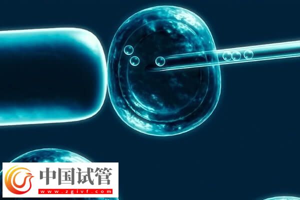 試管移植反復不著床需要查什么(圖1)