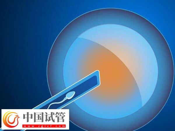 北華大學附屬醫院試管嬰兒是第幾代技術？(圖1)