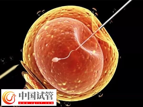 松原能做一代試管的三甲醫院是哪家？(圖1)