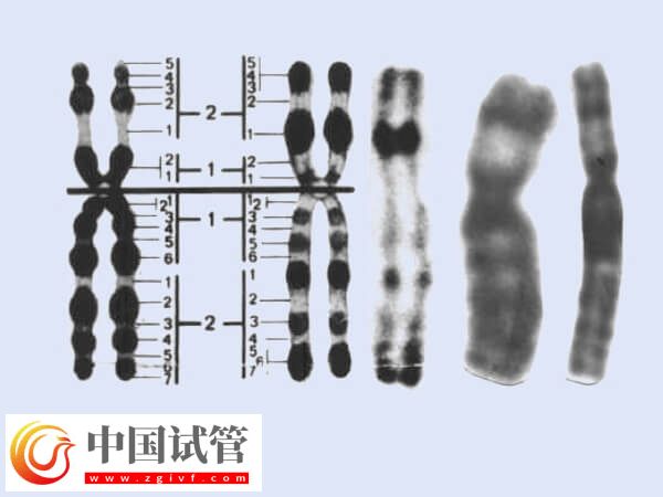 做試管2號染色體重復(fù)有什么影響(圖1)