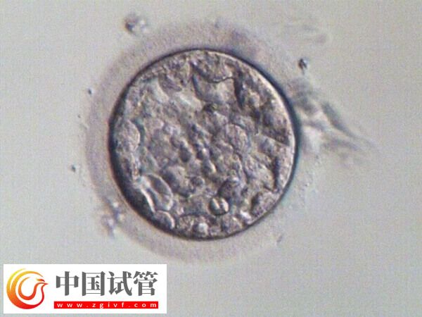 試管一次不成功二次移植費(fèi)用多少(圖3)