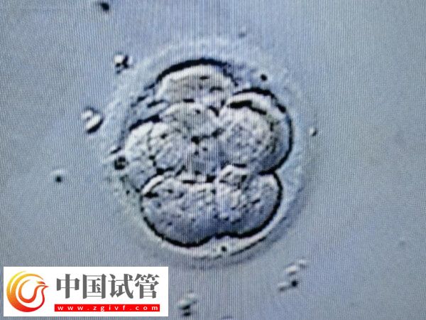 試管一次不成功二次移植費(fèi)用多少(圖2)