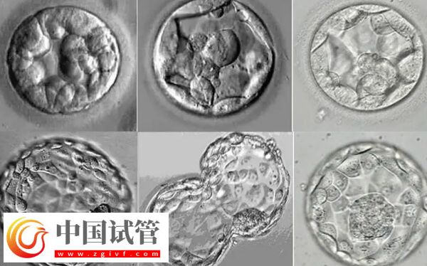 移植囊胚容易變成雙胞胎是怎么回事(圖1)