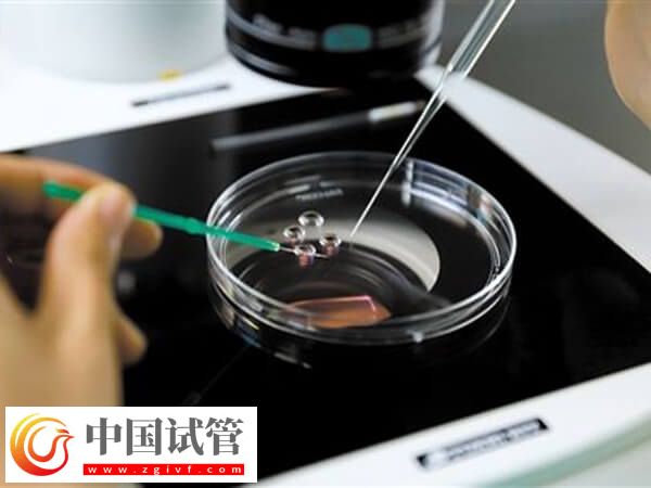 精子活力低做試管怎么辦(圖2)