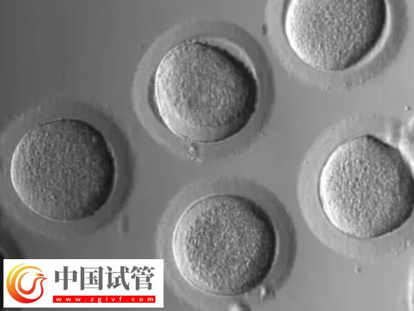 促排卵后卵泡不長(zhǎng)怎么辦(圖2) 促排卵后卵泡不長(zhǎng)怎么辦(圖2)