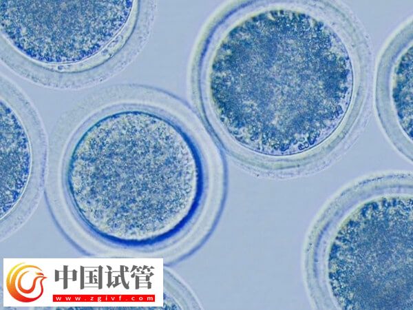 促排卵后卵泡不長(zhǎng)怎么辦(圖1) 促排卵后卵泡不長(zhǎng)怎么辦(圖1)