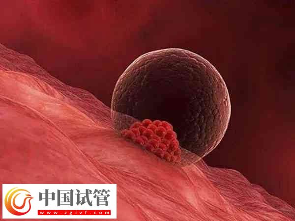 胚胎移植后會不會出現胎停(圖2)