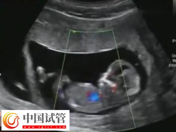 胚胎移植過后要注意這6點，飲食調理、定期產檢都在其中(圖2)