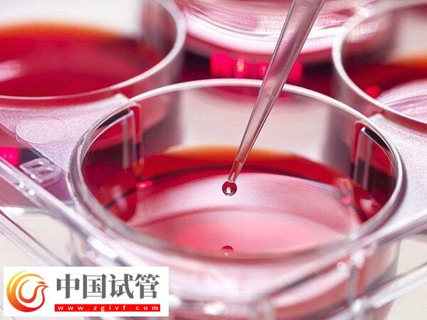 移植后如何知道胚胎著床了(圖1)