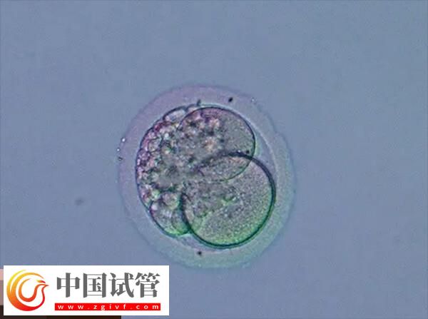 做試管月經不規律的移植方案分享，激素替代周期為其一(圖2)