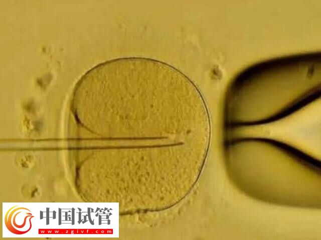 哪些人適合移植囊胚(圖1)