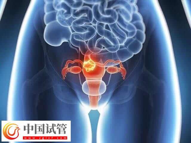 促排卵泡少可不可以降調(圖2)