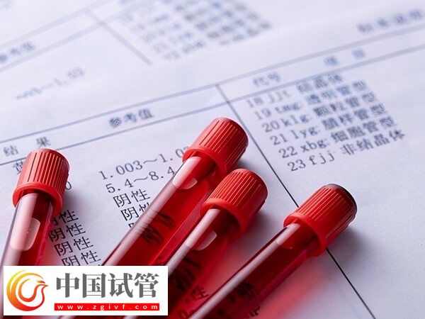 30歲促卵泡刺激素100多是怎么回事(圖1)