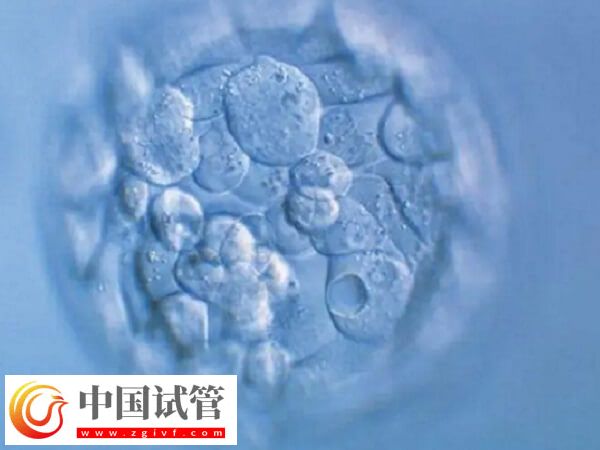 30歲促卵泡刺激素100多是怎么回事(圖2)