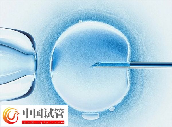 廣州能生男孩的試管醫院有哪些(圖2)