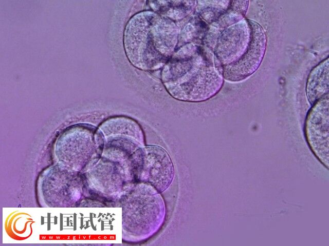 拮抗劑方案可不可以移植鮮胚(圖2)