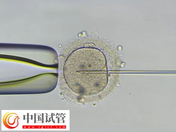 pgs篩查會淘汰多少囊胚(圖1) pgs篩查會淘汰多少囊胚(圖1)