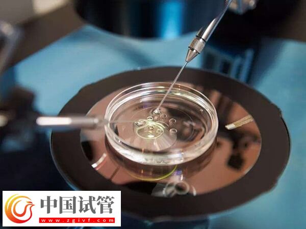 pgs篩查會淘汰多少囊胚(圖2) pgs篩查會淘汰多少囊胚(圖2)