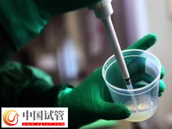 艾滋病洗精費(fèi)用是多少(圖2) 艾滋病洗精費(fèi)用是多少(圖2)