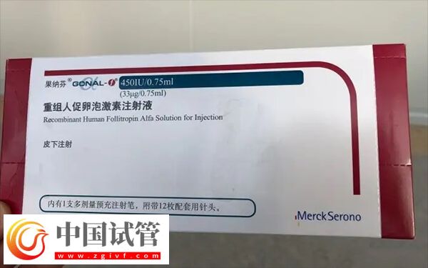 思則凱和果納芬區別是什么(圖2)