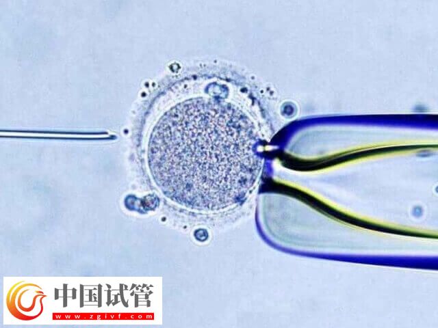 amh0.30做試管成功率多高(圖2)