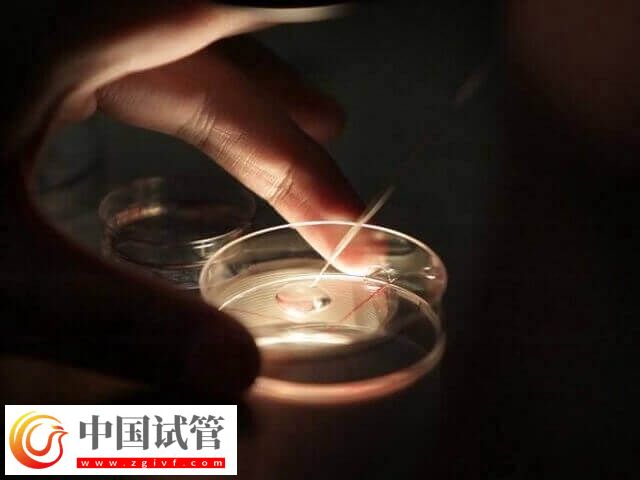 高齡是不是適合養囊胚(圖2)