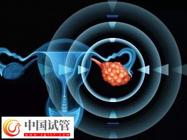 24歲卵巢早衰醫(yī)生說不用治怎么回事(圖1) 24歲卵巢早衰醫(yī)生說不用治怎么回事(圖1)