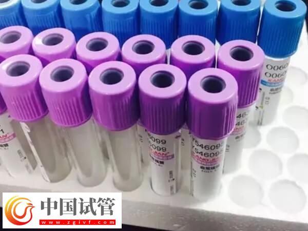 amh低會(huì)不會(huì)有優(yōu)勢(shì)卵泡發(fā)育(圖1) amh低會(huì)不會(huì)有優(yōu)勢(shì)卵泡發(fā)育(圖1)