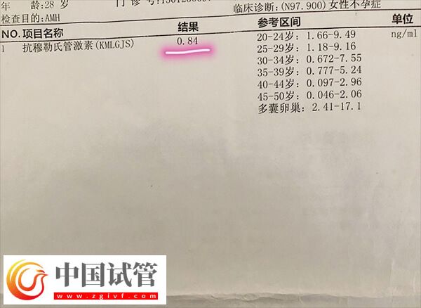 amh低會(huì)不會(huì)有優(yōu)勢(shì)卵泡發(fā)育(圖2) amh低會(huì)不會(huì)有優(yōu)勢(shì)卵泡發(fā)育(圖2)