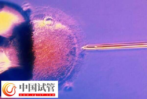 amh0.01試管有沒有成功的(圖2)