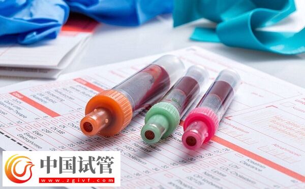 amh0.01試管有沒有成功的(圖1)