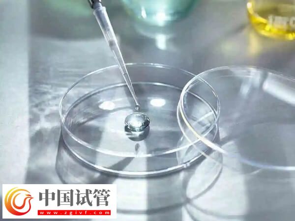 les試管嬰兒做一次多少錢了(圖1) les試管嬰兒做一次多少錢了(圖1)