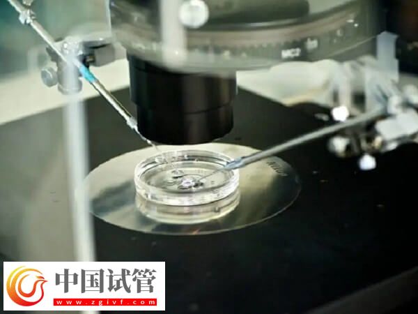 ivm和ivf哪個(gè)成功率高(圖2)