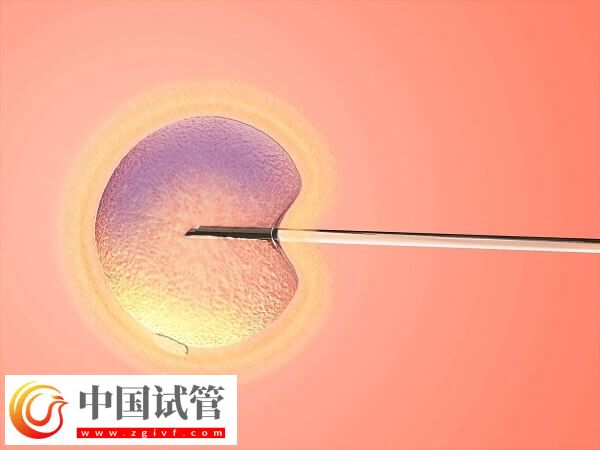 ivf和icsi哪個成功率高(圖2)