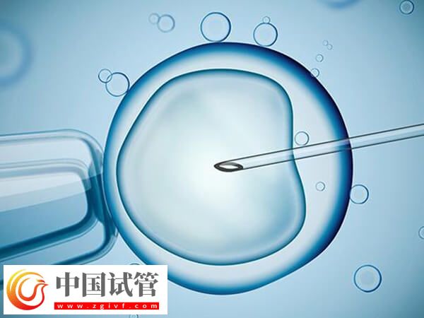 ivf和icsi的區(qū)別是什么(圖1) ivf和icsi的區(qū)別是什么(圖1)