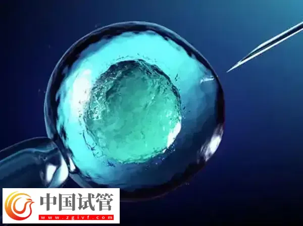 北京和上海做試管哪個技術(shù)好(圖2) 北京和上海做試管哪個技術(shù)好(圖2)