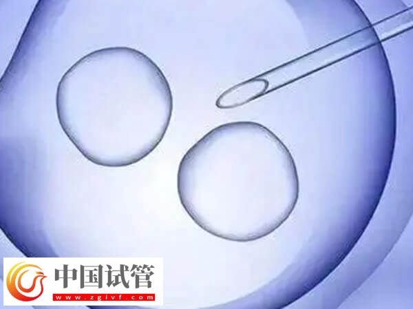 廣州能不能做HIV試管(圖1)