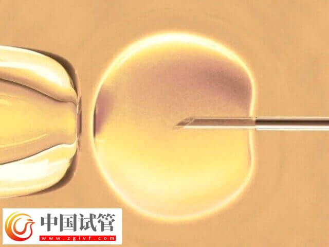 廣州哪里可以做試管三代(圖1)