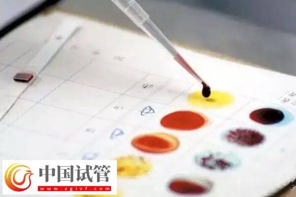 關節攣縮做試管有沒有影響(圖2)