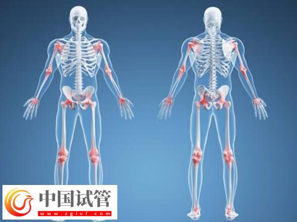 骨折愈合一年可不可以做試管(圖1) 骨折愈合一年可不可以做試管(圖1)