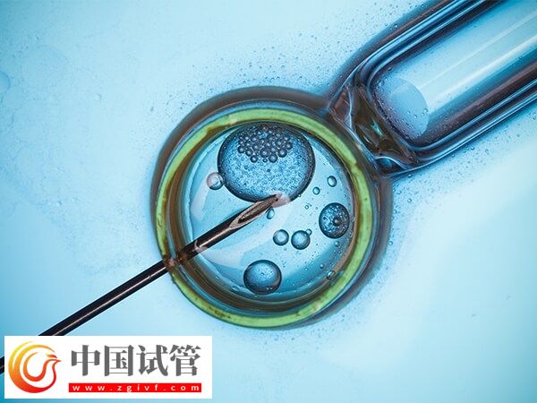 取卵后精卵不結(jié)合該怎么辦(圖1) 取卵后精卵不結(jié)合該怎么辦(圖1)