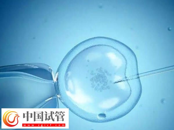 取卵后精卵不結(jié)合該怎么辦(圖2) 取卵后精卵不結(jié)合該怎么辦(圖2)