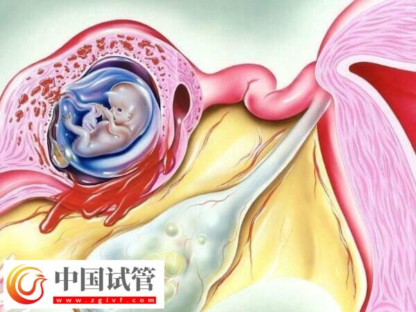 試管移植第三天出血是不是著床了(圖1)