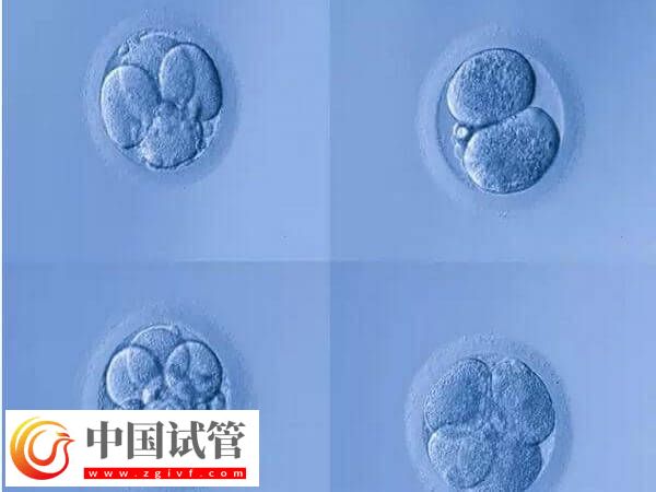 4aa的囊胚是什么級(jí)別？是最好的胚胎嗎？(圖1)